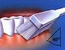 Zahnputztechnik - Zahnauenflchen unten