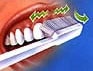 Zahnputztechnik - Zahnauenflchen oben
