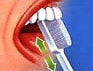 Zahnputztechnik - Zahnflchen innen